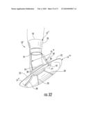 BARIATRIC DEVICE AND METHOD diagram and image