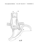 BARIATRIC DEVICE AND METHOD diagram and image