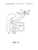 BARIATRIC DEVICE AND METHOD diagram and image