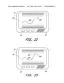 SIGNAL PROCESSING FOR CONTINUOUS ANALYTE SENSOR diagram and image