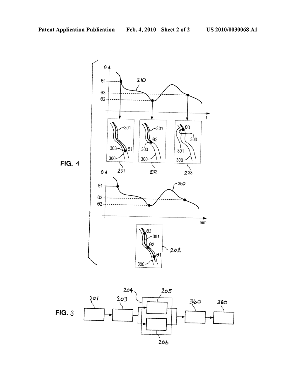 METHOD FOR PROCESSING IMAGES AND ASSOCIATED MEDICAL IMAGING SYSTEM - diagram, schematic, and image 03