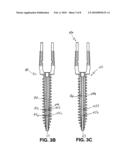 METHOD AND APPARATUS FOR ANCHORING BONE SCREWS AND INJECTING MANY TYPES OF HIGH VISCOSITY MATERIALS IN AREAS SURROUNDING BONE diagram and image