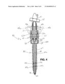 METHOD AND APPARATUS FOR ANCHORING BONE SCREWS AND INJECTING MANY TYPES OF HIGH VISCOSITY MATERIALS IN AREAS SURROUNDING BONE diagram and image