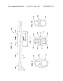 CATHETER SHAFT BOND ARRANGEMENTS AND METHODS diagram and image