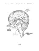 APHERESIS OF A TARGET MOLECULE FROM CEREBROSPINAL FLUID diagram and image