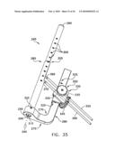 METHOD AND APPARATUS FOR FIXING A GRAFT IN A BONE TUNNEL diagram and image