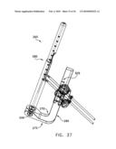 METHOD AND APPARATUS FOR FIXING A GRAFT IN A BONE TUNNEL diagram and image