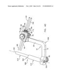 METHOD AND APPARATUS FOR FIXING A GRAFT IN A BONE TUNNEL diagram and image