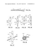 IMPLANTABLE SUPPORT DEVICE WITH GRAFT diagram and image