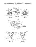 IMPLANTABLE SUPPORT DEVICE WITH GRAFT diagram and image