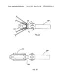 Dual Capture Device for Stent Graft Delivery System and Method for Capturing a Stent Graft diagram and image