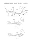 Dual Capture Device for Stent Graft Delivery System and Method for Capturing a Stent Graft diagram and image