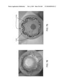 Dual Capture Device for Stent Graft Delivery System and Method for Capturing a Stent Graft diagram and image