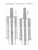 Dual Capture Device for Stent Graft Delivery System and Method for Capturing a Stent Graft diagram and image