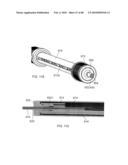 Dual Capture Device for Stent Graft Delivery System and Method for Capturing a Stent Graft diagram and image