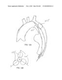 Dual Capture Device for Stent Graft Delivery System and Method for Capturing a Stent Graft diagram and image