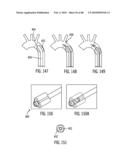 Dual Capture Device for Stent Graft Delivery System and Method for Capturing a Stent Graft diagram and image