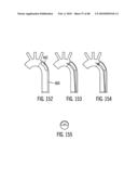 Dual Capture Device for Stent Graft Delivery System and Method for Capturing a Stent Graft diagram and image