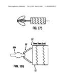 Dual Capture Device for Stent Graft Delivery System and Method for Capturing a Stent Graft diagram and image