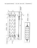 Dual Capture Device for Stent Graft Delivery System and Method for Capturing a Stent Graft diagram and image