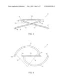 Apparatus for Treating a Heart Valve, in Particular a Mitral Valve diagram and image