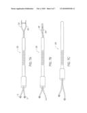 Apparatus for Treating a Heart Valve, in Particular a Mitral Valve diagram and image