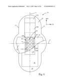 Zoned Topsheet diagram and image