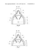 ARTIFICIAL TEETHRIDGE AND FANG diagram and image