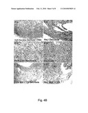 METHOD OF TREATING INTRAUTERINE INFLAMMATION diagram and image