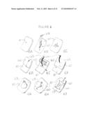 Methods and apparatus for transesophageal microaccess surgery diagram and image