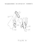 Methods and apparatus for transesophageal microaccess surgery diagram and image