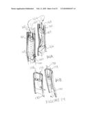 Methods and apparatus for transesophageal microaccess surgery diagram and image