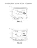 SYSTEMS AND METHODS FOR REPLACING SIGNAL ARTIFACTS IN A GLUCOSE SENSOR DATA STREAM diagram and image