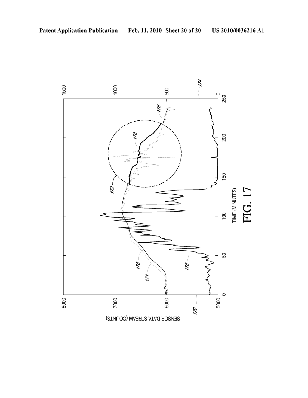 SYSTEMS AND METHODS FOR REPLACING SIGNAL ARTIFACTS IN A GLUCOSE SENSOR DATA STREAM - diagram, schematic, and image 21