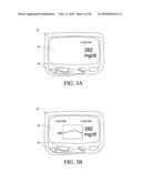 SYSTEMS AND METHODS FOR REPLACING SIGNAL ARTIFACTS IN A GLUCOSE SENSOR DATA STREAM diagram and image