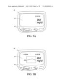 SYSTEMS AND METHODS FOR REPLACING SIGNAL ARTIFACTS IN A GLUCOSE SENSOR DATA STREAM diagram and image