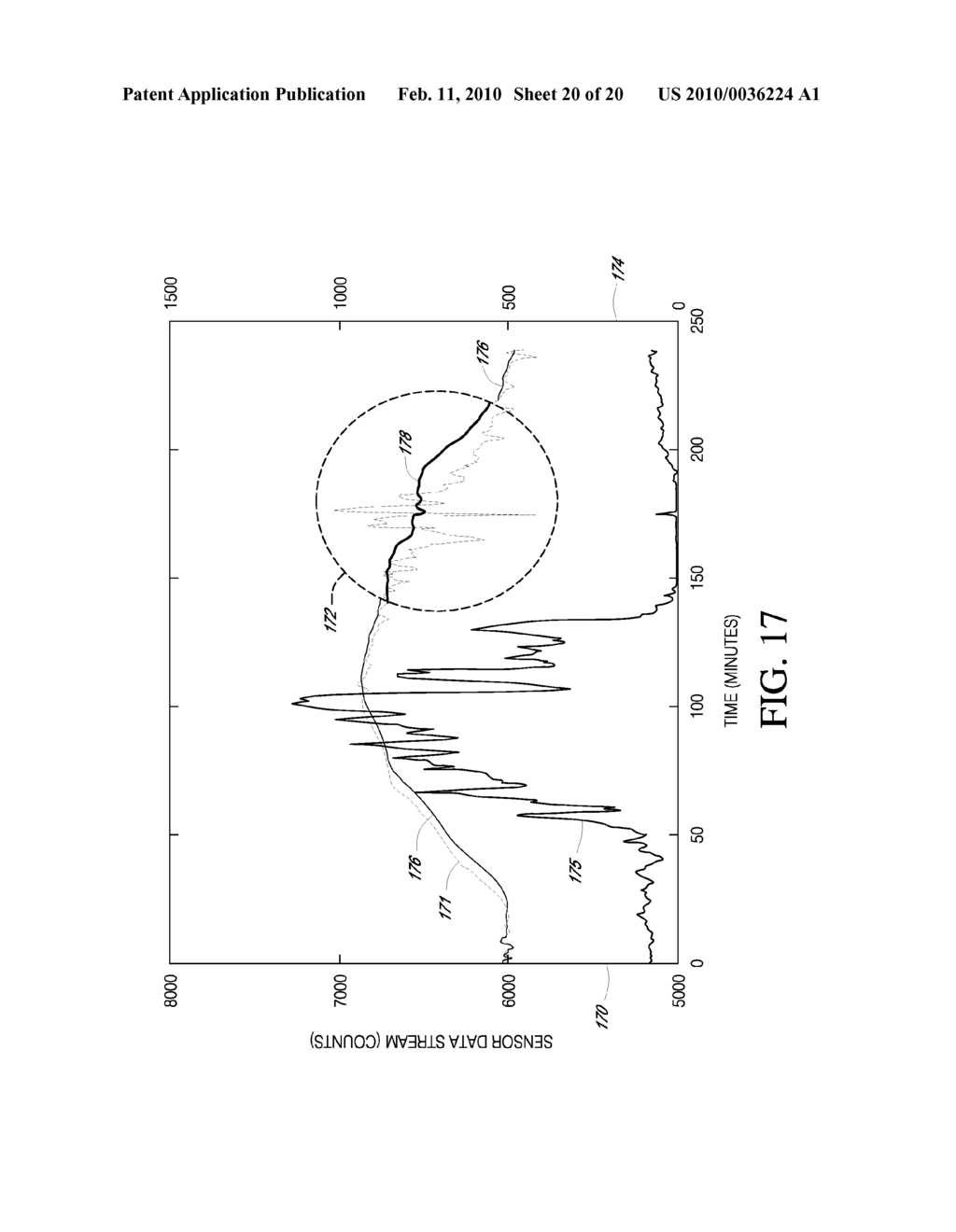 SYSTEMS AND METHODS FOR REPLACING SIGNAL ARTIFACTS IN A GLUCOSE SENSOR DATA STREAM - diagram, schematic, and image 21