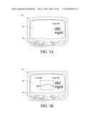 SYSTEMS AND METHODS FOR REPLACING SIGNAL ARTIFACTS IN A GLUCOSE SENSOR DATA STREAM diagram and image