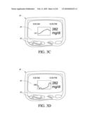 SYSTEMS AND METHODS FOR REPLACING SIGNAL ARTIFACTS IN A GLUCOSE SENSOR DATA STREAM diagram and image