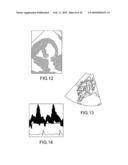 SYSTEM AND METHOD FOR MANAGING A PATIENT diagram and image