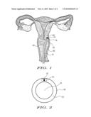 Uterine Infrared Thermal Imaging Device diagram and image