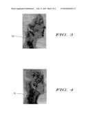 Uterine Infrared Thermal Imaging Device diagram and image