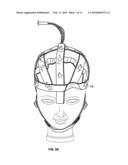 EEG NET WITH TRANSMISSION CAPABILITIES diagram and image