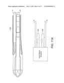 Radially-Firing Electrohydraulic Lithotripsy Probe diagram and image