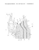 Orthopaedic Devices diagram and image