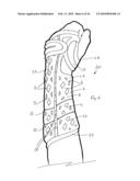 Orthopaedic Devices diagram and image