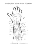 Orthopaedic Devices diagram and image