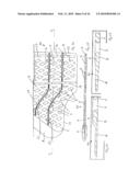 Orthopaedic Devices diagram and image