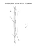 Orthopaedic Devices diagram and image