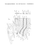 Orthopaedic Devices diagram and image